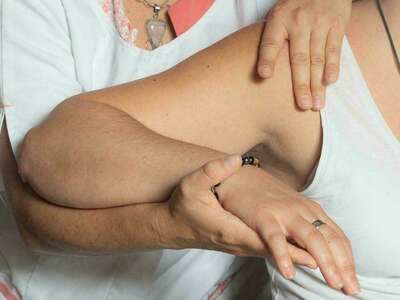 Troubles locomoteurs